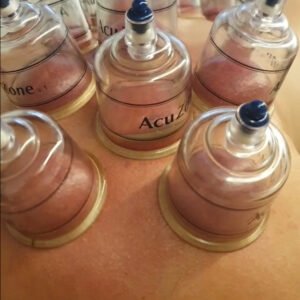 Ventosas Terapéuticas (Cupping) por Zona | La Fisio